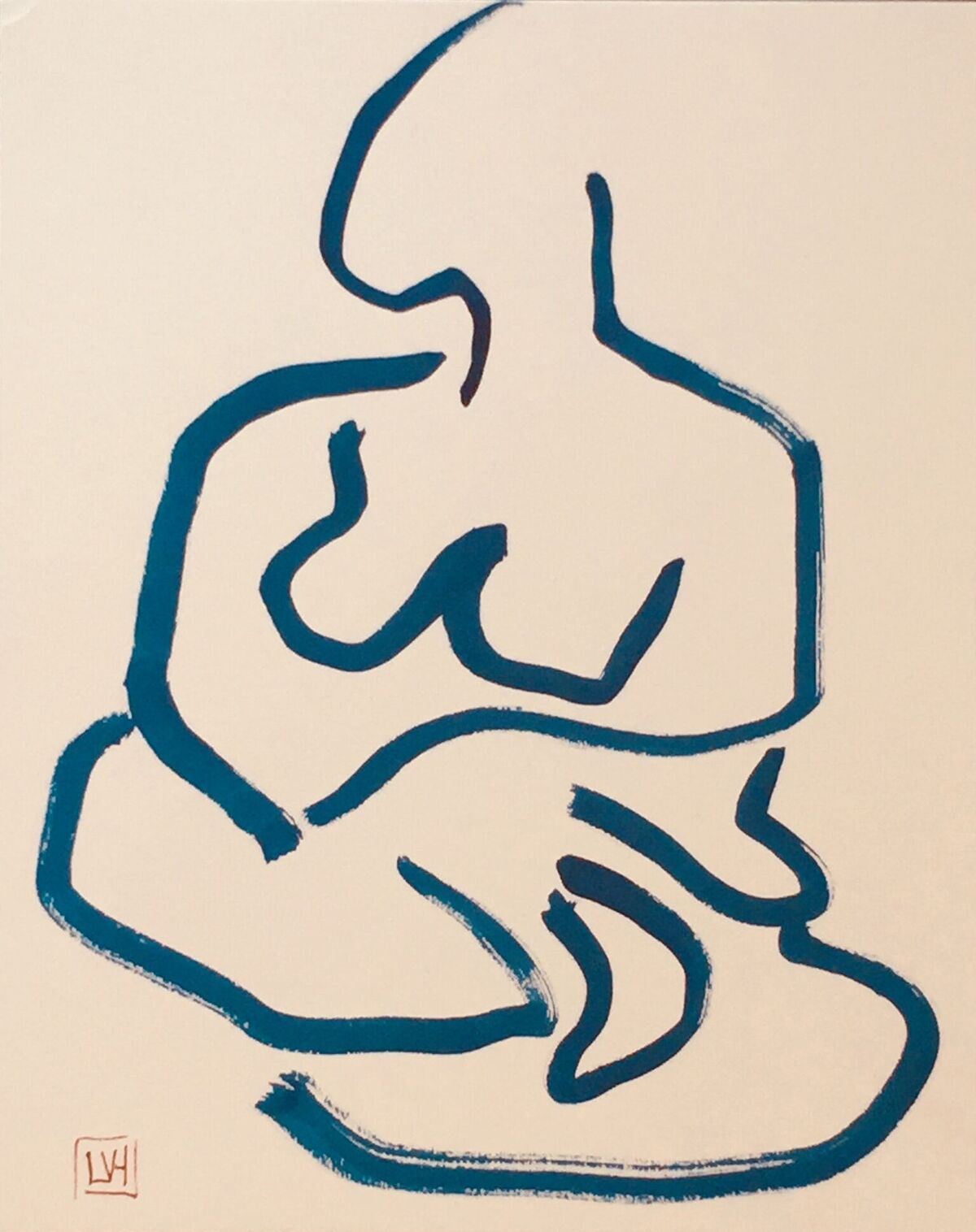Figure XIII
